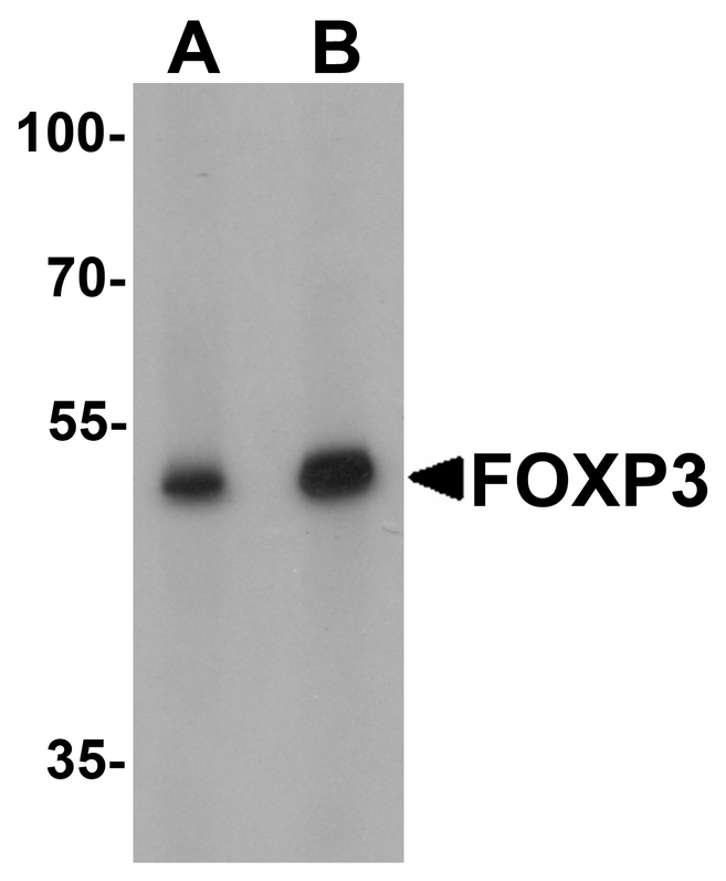 Western blot analysis of FOXP3 in A549 cell lysate with FOXP3 antibody at (A) 1 and (B) 2 ug/ml.