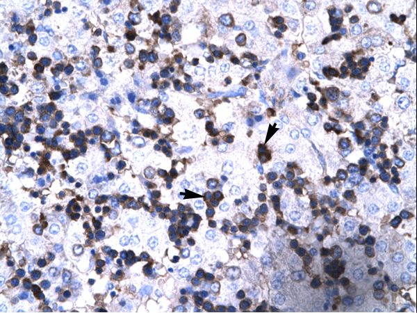 FOXP3 antibody LS-C31026 was used in IHC to stain formalin-fixed, paraffin-embedded human liver.