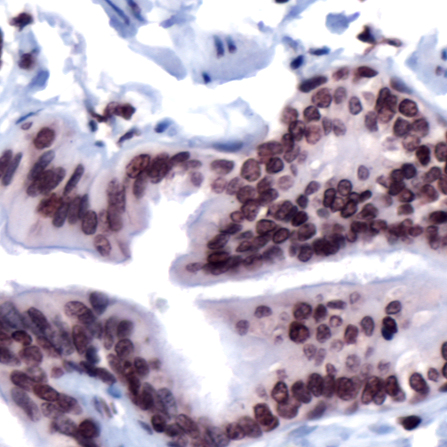 Immunohistochemistry of Human Lung stained with anti-FOXP4 antibody