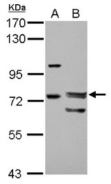 Sample (30 ug of whole cell lysate) A: HeLa B: HeLa nucleus 7.5% SDS PAGE FOXP4 antibody diluted at 1:1000