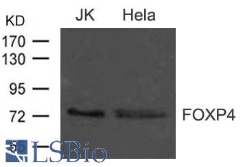 Western blot of extract from JK and HeLa cells using FOXP4 antibody