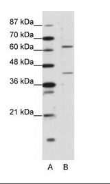 A: Marker, B: Rap Cell Lysate