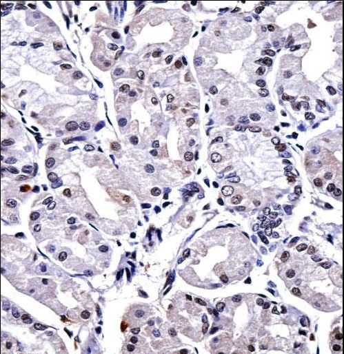 FOXP4 Antibody immunohistochemistry of formalin-fixed and paraffin-embedded human stomach tissue followed by peroxidase-conjugated secondary antibody and DAB staining.