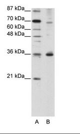 A: Marker, B: HepG2 Cell Lysate