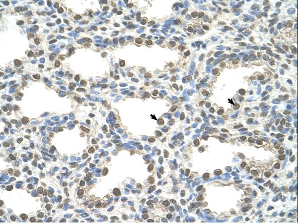 FOXQ1 antibody LS-C40293 was used in IHC to stain formalin-fixed, paraffin-embedded human lung.