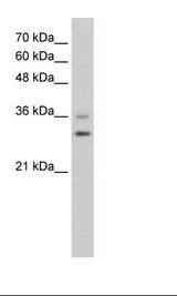 HepG2 Cell Lysate