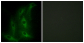 Immunofluorescence of HeLa cells, using Collagen IV alpha6 Antibody. The picture on the right is treated with the synthesized peptide.
