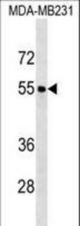 FOXQ1 Antibody western blot of MDA-MB231 cell line lysates (35 ug/lane). The FOXQ1 antibody detected the FOXQ1 protein (arrow).