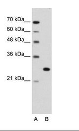 A: Marker, B: Jurkat Cell Lysate