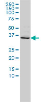 FOXR2 monoclonal antibody (M01), clone 2C1 Western blot of FOXR2 expression in HeLa.