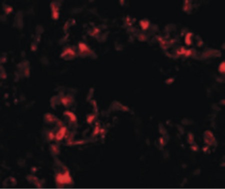 Immunofluorescence of FOXRED2 in human lung cells with FOXRED2 antibody at 20 ug/ml.