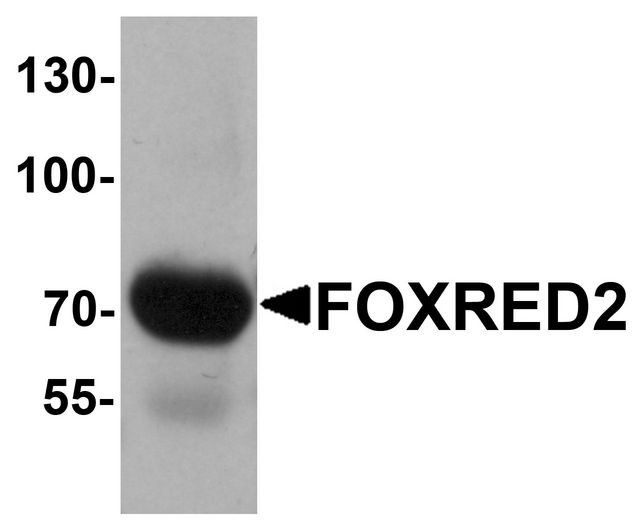 Western blot analysis of FOXRED2 in human lung tissue lysate with FOXRED2 antibody at 1 ug/ml.