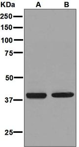 Western blot analysis on (A) MCF-7 and (B) T47-D cell lysates using anti-PTGFR antibody.
