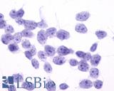 Anti-PTGFR antibody LS-A1049 immunocytochemistry (ICC) staining of untransfected HEK293 human embryonic kidney cells.