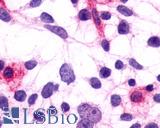 Anti-PTGFR antibody LS-A1049 immunocytochemistry (ICC) staining of HEK293 human embryonic kidney cells transfected with PTGFR.