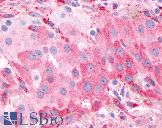 Anti-PTGFR antibody LS-A6624 IHC of human ovary. Immunohistochemistry of formalin-fixed, paraffin-embedded tissue after heat-induced antigen retrieval.