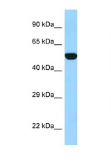 FPGS antibody LS-C146171 Western blot of Fetal Heart lysate. Antibody concentration 1 ug/ml.