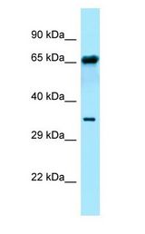 FPGT antibody Western Blot of ACHN.