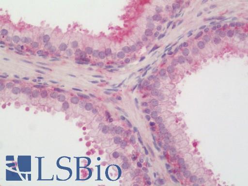 Human Prostate: Formalin-Fixed, Paraffin-Embedded (FFPE)