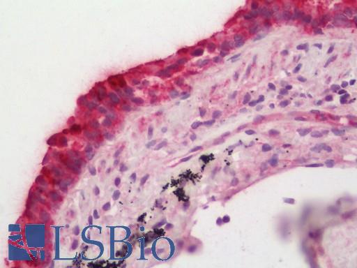 Human Lung: Formalin-Fixed, Paraffin-Embedded (FFPE)