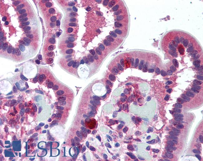 Anti-FPR1 antibody IHC of human small intestine. Immunohistochemistry of formalin-fixed, paraffin-embedded tissue after heat-induced antigen retrieval. Antibody LS-B2027 concentration 10 ug/ml.