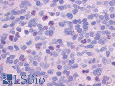 Anti-FPR1 antibody LS-A2085 IHC of human spleen. Immunohistochemistry of formalin-fixed, paraffin-embedded tissue after heat-induced antigen retrieval.