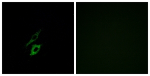 Immunofluorescence of A549 cells, using FPR1 Antibody. The picture on the right is treated with the synthesized peptide.