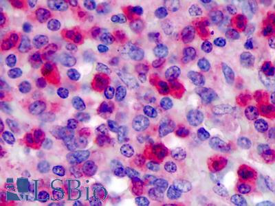 Anti-FPR1 antibody IHC of human spleen. Immunohistochemistry of formalin-fixed, paraffin-embedded tissue after heat-induced antigen retrieval. Antibody LS-B4873 concentration 5 ug/ml.