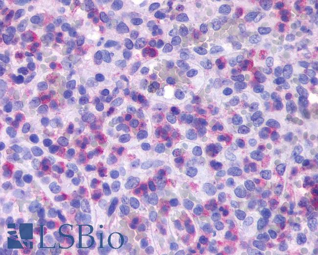 Anti-FPR1 antibody LS-A2087 IHC of human spleen, red pulp. Immunohistochemistry of formalin-fixed, paraffin-embedded tissue after heat-induced antigen retrieval.
