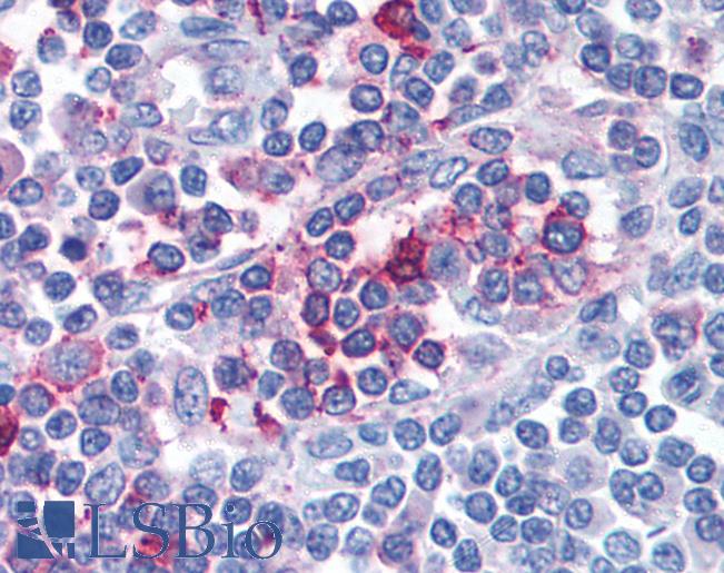 Anti-FPR1 antibody LS-A2088 IHC of human lymph node. Immunohistochemistry of formalin-fixed, paraffin-embedded tissue after heat-induced antigen retrieval.