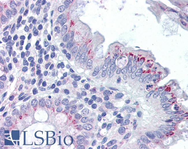 Anti-FPR2 / FPRL1 antibody IHC of human colon. Immunohistochemistry of formalin-fixed, paraffin-embedded tissue after heat-induced antigen retrieval. Antibody LS-B2911 concentration 5 ug/ml.