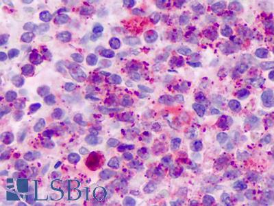 Anti-FPR2 / FPRL1 antibody IHC of human spleen, neutrophils. Immunohistochemistry of formalin-fixed, paraffin-embedded tissue after heat-induced antigen retrieval. Antibody LS-A1880 dilution 20-40 ug/ml.
