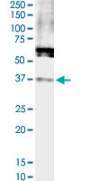 FPR2 monoclonal antibody (M02), clone 2D8. Western Blot analysis of FPR2 expression in HeLa NE.