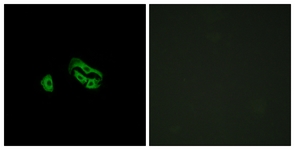 Immunofluorescence of HeLa cells, using FPRL2 Antibody. The picture on the right is treated with the synthesized peptide.