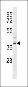 FPR3 Antibody western blot of ZR-75-1 cell line lysates (35 ug/lane). The FPR3 antibody detected the FPR3 protein (arrow).