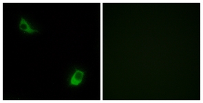 Immunofluorescence of LOVO cells, using FPRL2 Antibody. The picture on the right is treated with the synthesized peptide.