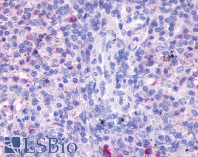 Anti-FPR3 / FPRH2 antibody LS-A3733 IHC of human spleen. Immunohistochemistry of formalin-fixed, paraffin-embedded tissue after heat-induced antigen retrieval.