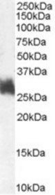 Antibody (1 ug/ml) staining of Human Bone Marrow lysate (35 ug protein in RIPA buffer). Primary incubation was 1 hour. Detected by chemiluminescence.