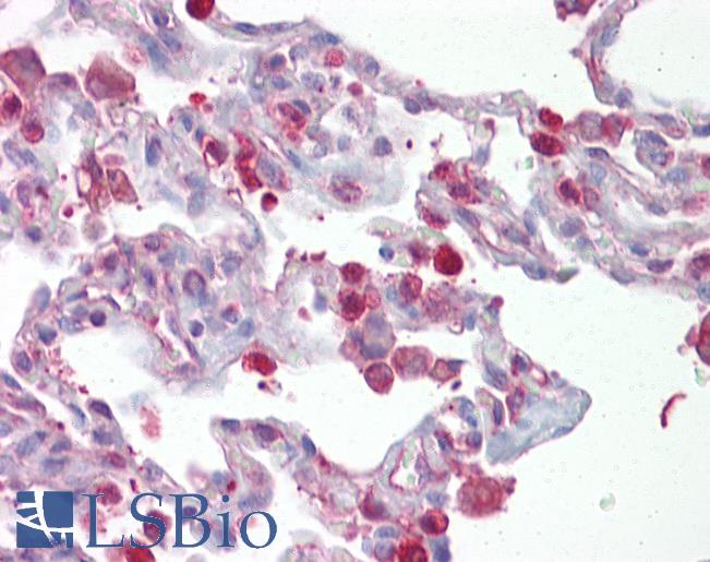 Anti-FOSL1 / FRA1 antibody IHC of human lung. Immunohistochemistry of formalin-fixed, paraffin-embedded tissue after heat-induced antigen retrieval. Antibody LS-B6677 concentration 5 ug/ml.