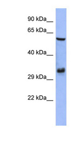 FOSL1 / FRA1 antibody LS-B6677 Western blot of HepG2 cell lysate.