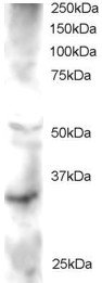 Antibody staining (2 ug/ml) of Human Heart lysate (RIPA buffer, 30 ug total protein per lane). Primary incubated for 1 hour. Detected by Western blot of chemiluminescence.
