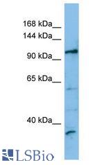 FRBZ1 / ZBTB41 antibody Western Blot of THP-1. Antibody dilution: 1 ug/ml.