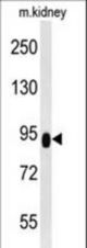 ZBTB41 Antibody western blot of mouse kidney tissue lysates (35 ug/lane). The ZBTB41 antibody detected the ZBTB41 protein (arrow).