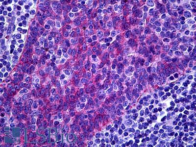Anti-FREM1 antibody IHC of human tonsil. Immunohistochemistry of formalin-fixed, paraffin-embedded tissue after heat-induced antigen retrieval. Antibody LS-B5486 concentration 10 ug/ml.