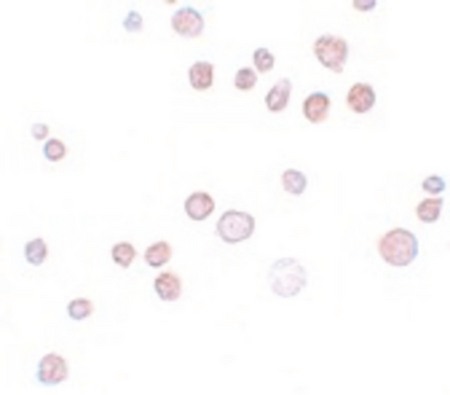 Immunocytochemistry of FREM1 in K562 cells with FREM1 antibody at 20 ug/ml.