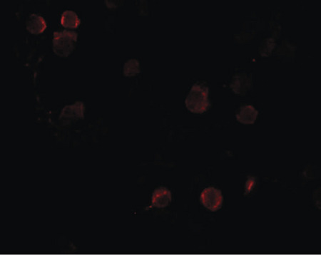 Immunofluorescence of FREM1 in K562 cells with FREM1 antibody at 20 ug/ml.