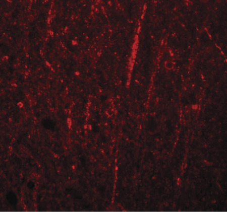 Immunofluorescence of FRMPD4 in human brain tissue with FRMPD4 antibody at 20 ug/ml.