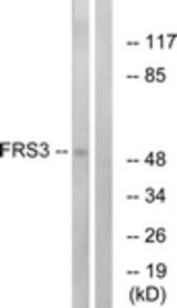 Western blot of extracts from COS7 cells, using FRS3 Antibody. The lane on the right is treated with the synthesized peptide.