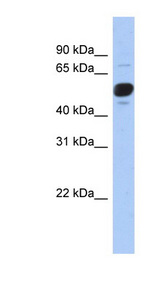 FRS3 antibody LS-C111387 Western blot of DU145 cell lysate.