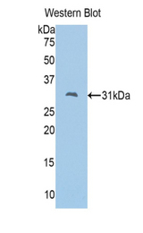 Western blot of recombinant FSCN2 / Retinal Fascin.